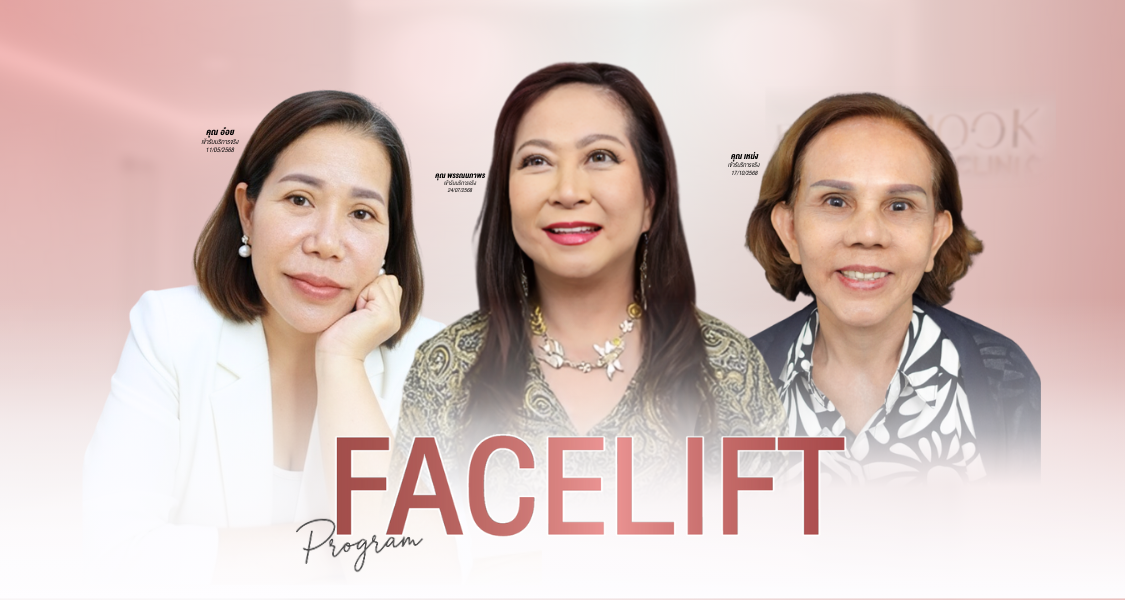 facelift